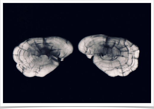 Sagittal otoliths of Striped Rockcod (Trematomus hanson) from Southern Ocean. 